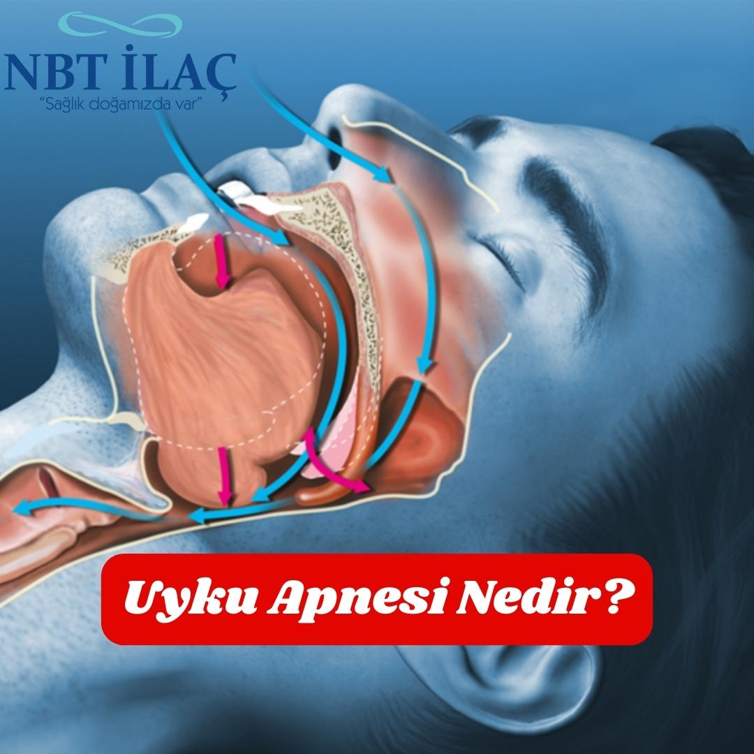 Uyku Apnesi Nedir Neden Olur NBT la uyku-apnesi-nedir-neden-olur-nbt-la