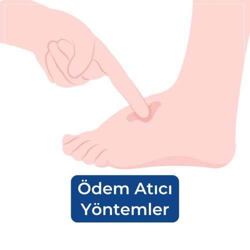 odem-atici-yontemler
