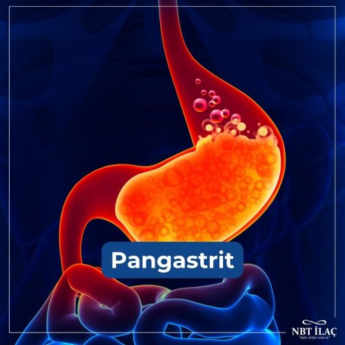 pangastrit