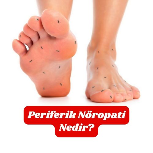 periferik-noropati